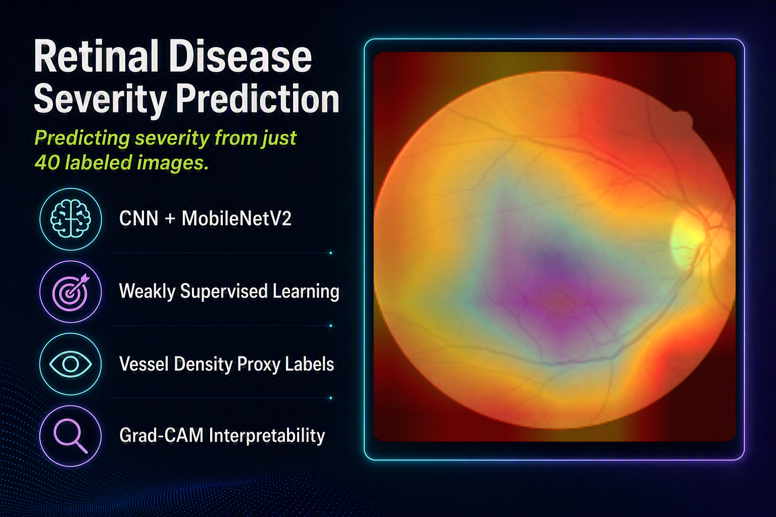 Retinal disease severity prediction with Grad-CAM